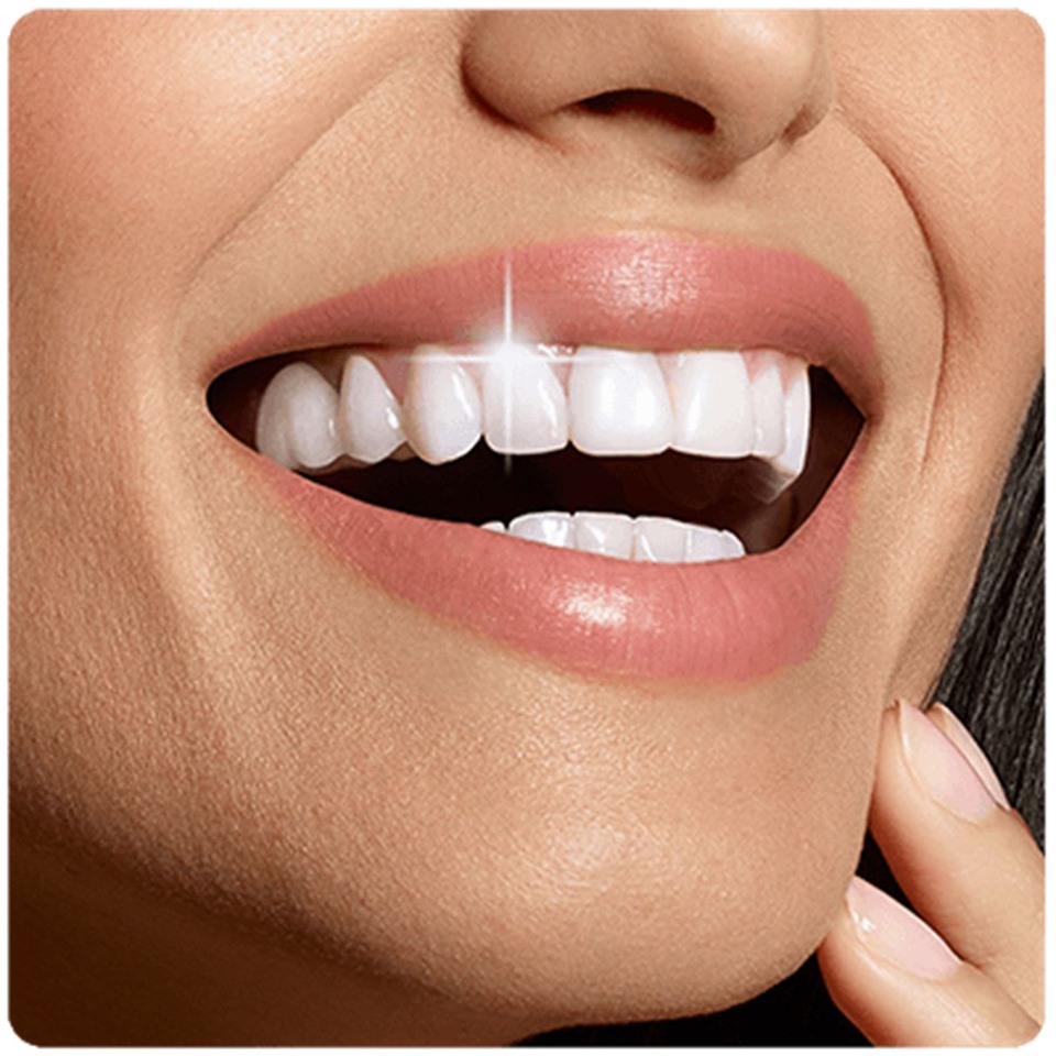 Professional teeth whitening