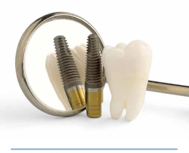 Dental implant & oral surgery